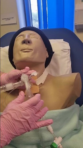 Tracheostomy Closed Suction