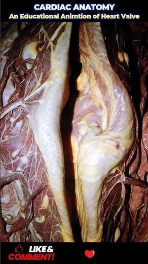 #HeartAnatomy #MedicalEducation