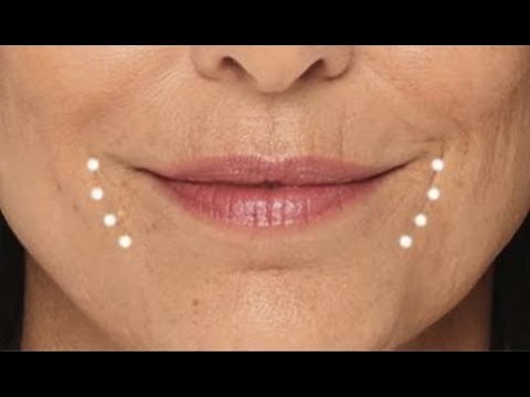 Smoothing Marionette Lines Massage