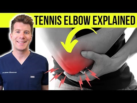 Doctor explains TENNIS ELBOW (lateral epicondylitis) | Symptoms, causes, & treatment