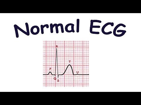 Normal ECG