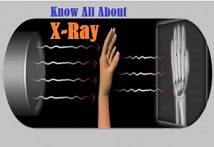 X-Ray Radiography - Types, How it Works, Applications and Advantages