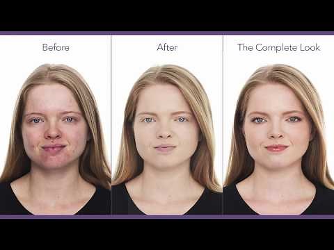 Cover Acne & Scars: Makeup Tutorial for Acne | jane iredale