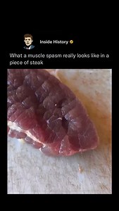5.3M views · 16K reactions | A muscle spasm is an unexpected,...