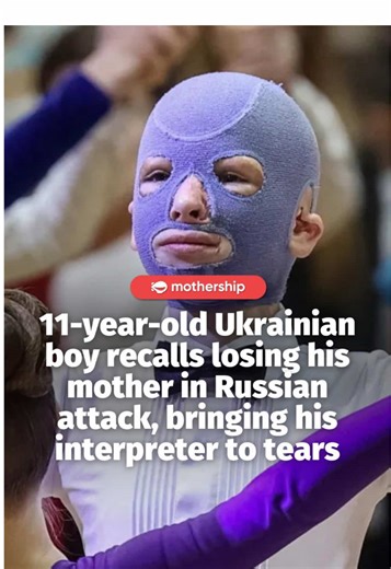 Despite going through painful recovery after 36 surgeries, Roman returned to school, dancing, and music. His inspiring story was adapted into an award-winning film ‘Romchyk’. #ukraine #boy #news