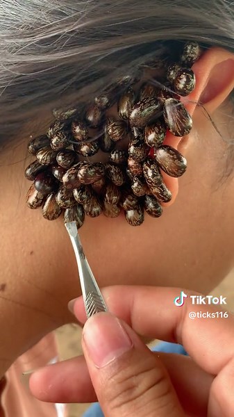 Removing Ticks Safely: A Guide to Tick Attack and Red Tick Removal