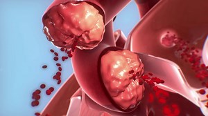 26K views · 214 reactions | Your heart works hard to pump your blood -- take a fascinating look at what happens when one of its valves stops working like it should. | WebMD | Facebook