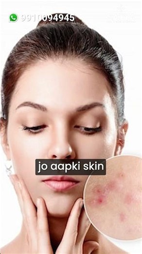 “Toothpaste Cures Pimples? - Dermatologist Reacts!”