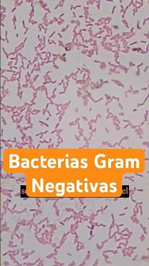 This is how Gram-negative bacteria look under a microscope #bacteriology #clinicallaboratory