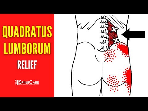 How to Fix Quadratus Lumborum Pain FOR GOOD