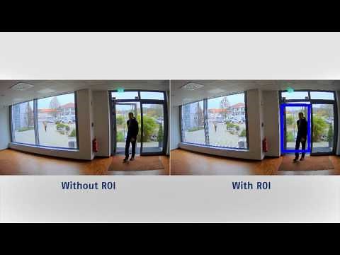 ROI (region of interest)