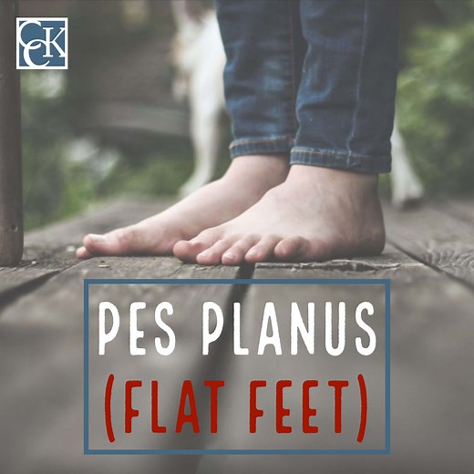 VA Disability for Pes Planus (Flat Feet) | CCK Law
