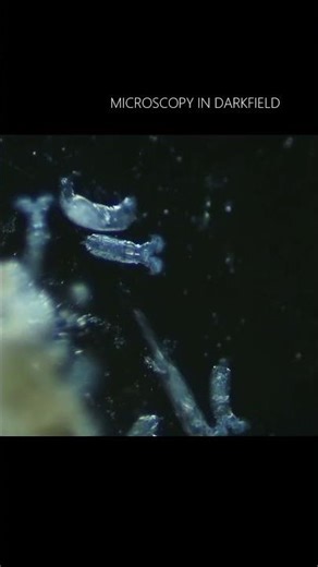 It's "dark" in microscopic world! #microscopy #science #biology