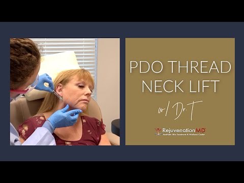 PDO Thread Neck Lift