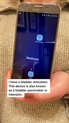 Understanding the Interstim Bladder Pacemaker Technology