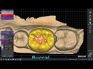 .محاضره 《1》exocad بالمصرى مع وليد منصور Free exocad course With walid Mansour Like& Subscribe& Share