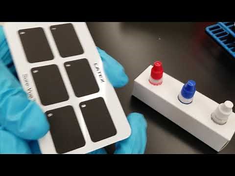 Immunology: RF & sLE Latex Agglutination Tests