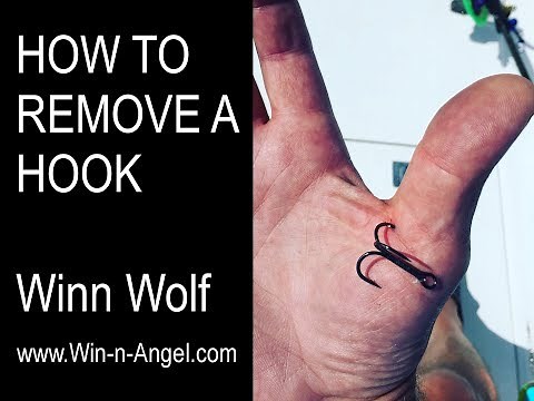 HOW TO REMOVE A FISHING HOOK
