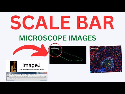 How to a scale bar to microscopic images by Image J software