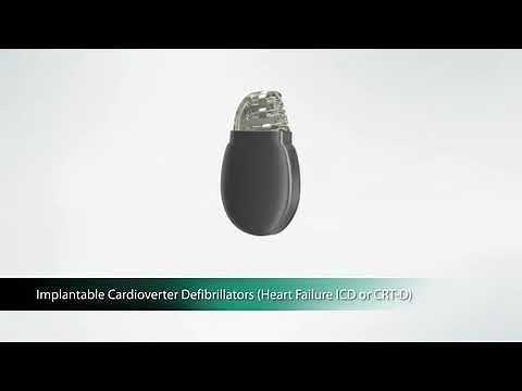 CRT-D Implantation