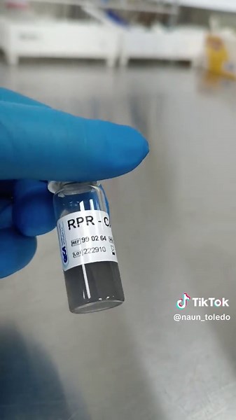 Diferencia entre VDRL y RPR en el laboratorio