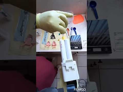 Colocación de hilo retractor y toma de impresión fisiológica