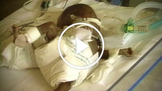 Crack Babies: A Tale From the Drug Wars