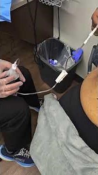 Pleurx: For draining at home | Cancer Vlog