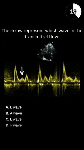 Echocardiography board practice question #27