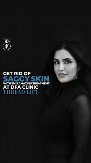 22K views · 319 reactions | A thread lift is a new facial...