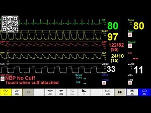 Timed Simulated Patient ICU Monitor