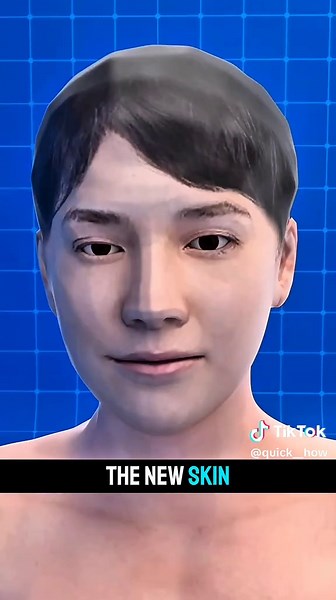 3D Medical Animation: Skin Grafting for Burn Healing