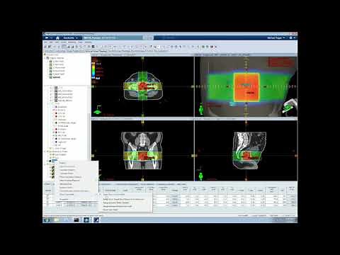 Tutorial 4 Basic 3D Planning in Eclipse