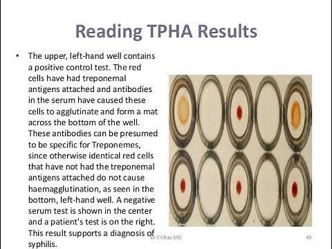 TPHA Test-Positive