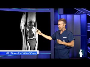 Ganglion Cyst Surgery