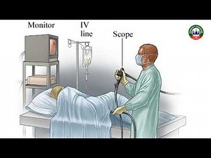 Surgery Topic: Sigmoidoscopy