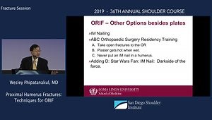 Proximal Humerus Fractures: Techniques for ORIF