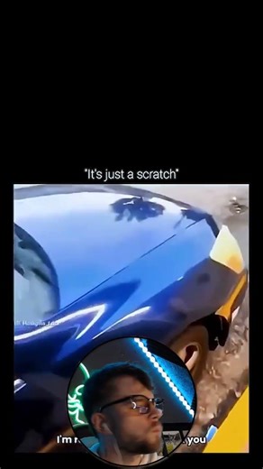 It’s just a scratch 💀