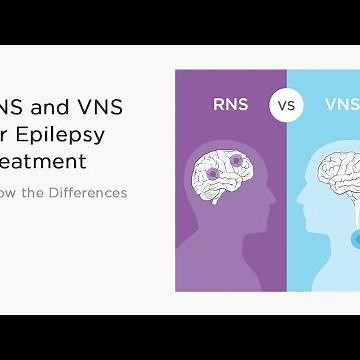 RNS and VNS for Epilepsy Treatment - Know the Differences