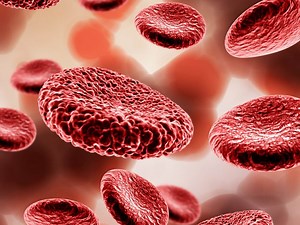 Oxyhemoglobin Method for Estimation of Hemoglobin