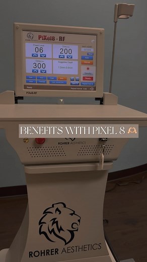 Pixel8-RF, our latest innovation in Radio Frequency Microneedling. Pixel8 channels energy through tiny needles, stimulating collagen and revitalizing skin, targeting fine lines, wrinkles, and uneven texture while enhancing firmness and elasticity. Minimal downtime, maximum results. • • • 📍EL PASO COSMETIC SURGERY ☎️(915)351-1116 (call or text) to schedule your consultation today! #injectables #pixel8rf #medspa #facials #lasers #medicalaesthetician #nurseinjector #elpaso #texas #explorepage #exp