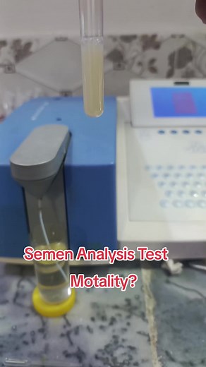 Semen Analysis Lab Test Explained