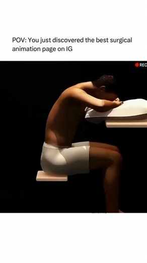 Nursing student🩺💉💊🧬🩹 on Instagram: "Thoracentesis is a medical procedure where a hollow needle is inserted through the chest wall to remove excess fluid or air from the pleural space—the area between the lungs and the chest wall. It is performed for diagnostic purposes to determine the cause of a pleural effusion and to provide relief from symptoms like difficulty breathing by removing the buildup of fluid. The procedure often involves using ultrasound to guide the needle and may be followe