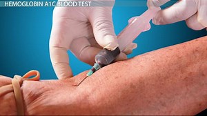 Hemoglobin A1C Blood Test: Description & Optimal Ranges