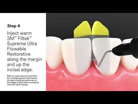 3M™ Bioclear™ - Black Triangle Animation