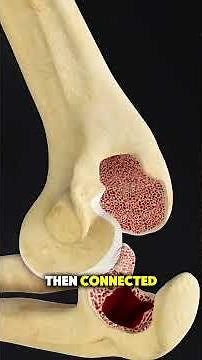 Elbow Joint Replacement Surgery | Procedure, Steps & Recovery Explained #ElbowReplacement