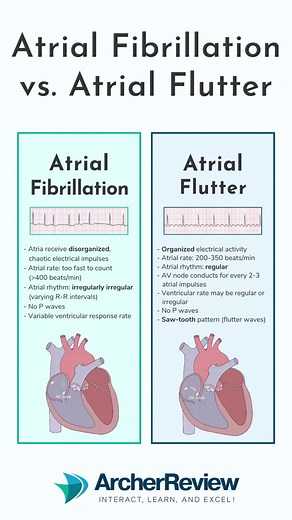 Atrial Fibrillation vs Atrial Flutter: Key Differences Explained