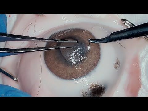 Cornea Suture 101