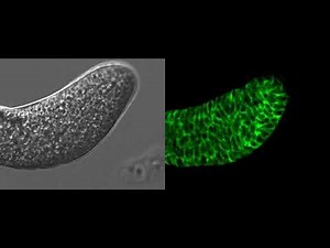 細胞性粘菌の移動体内の個々の細胞の動き