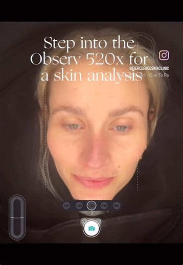 Have you ever wondered what your skin looks like beneath the surface? The Observ 520x reveals everything – from pigmentation lurking below to hydration levels and pore visibility. This advanced technology helps both us, as the clinicians, and you, as the clients, better understand your skin’s needs, making treatment plans more precise and results more effective. At Fierce Face, we use the Observ 520x as part of your long-term skincare journey. We aim to be a genuinely personalised skin clinic, c